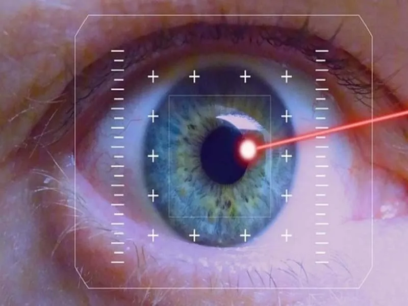 Glaucoma Diagnosis & Laser Treatment in Indore