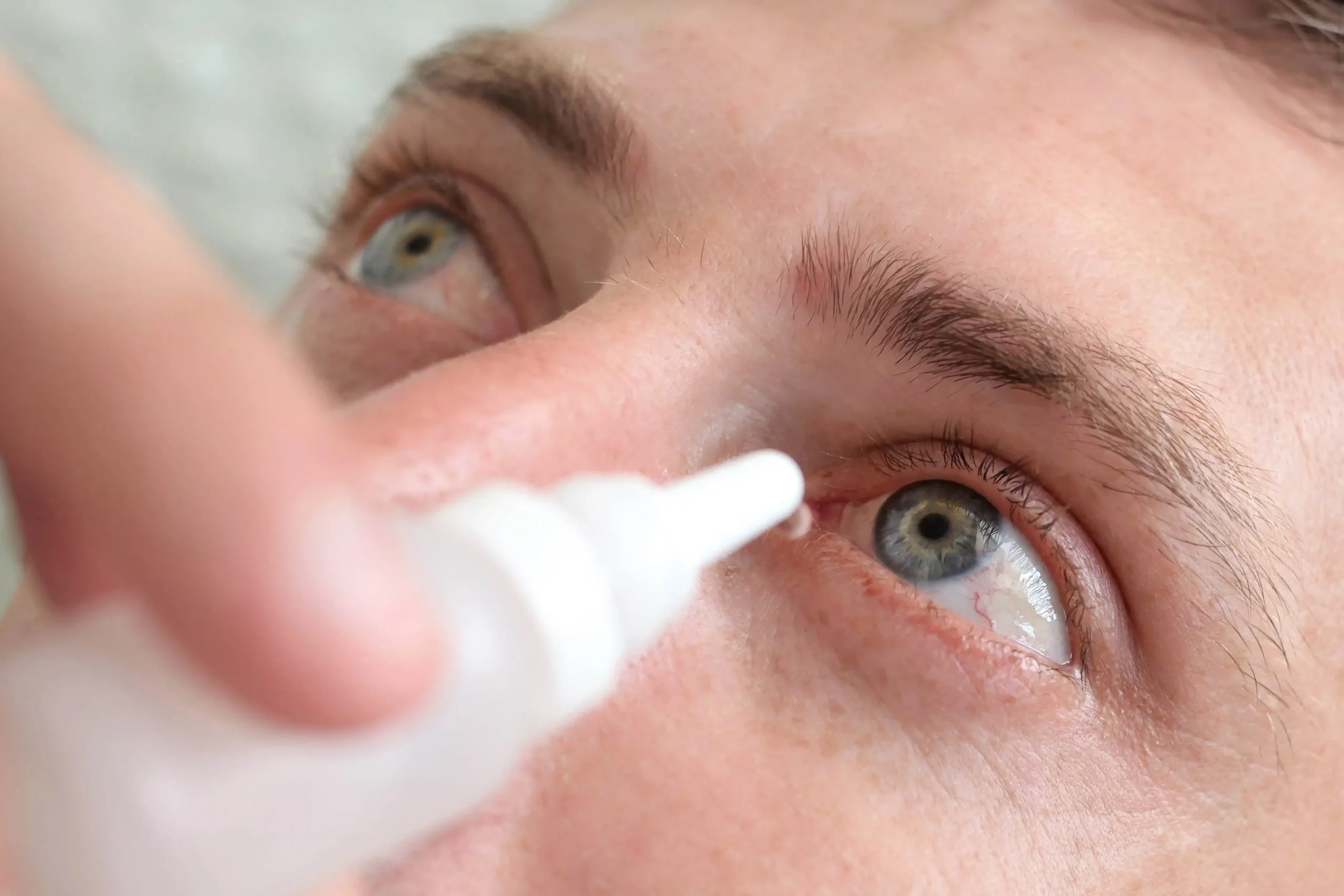 Dry Eye Syndrome & Eye Allergies