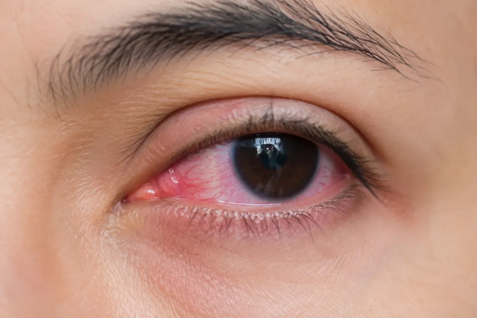Red Eye in the Rainy Season