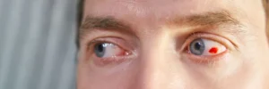 Eye floaters appearing as small dark specks and thread-like shapes drifting across a person’s field of vision, illustrating the difference between harmless floaters and potential warning signs of retinal problems.